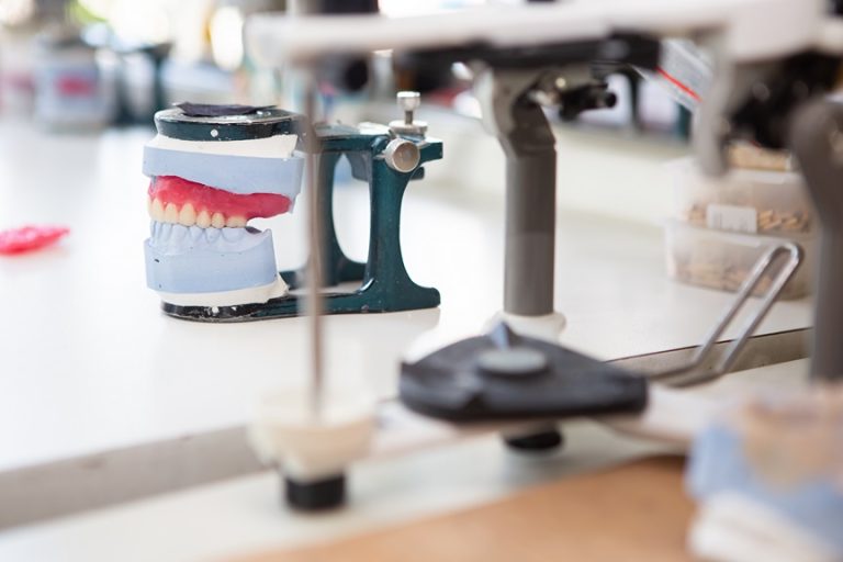 Исправление прикуса: что будет, если не лечить? Скрытые угрозы: от стираемости зубов до проблем с позвоночником