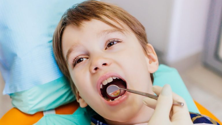 Можно ли детям лечить зубы под седацией